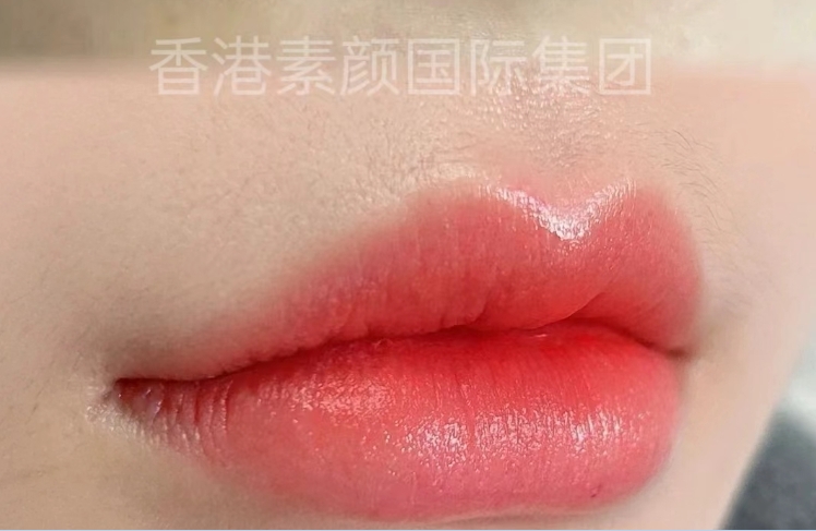 唇部美学