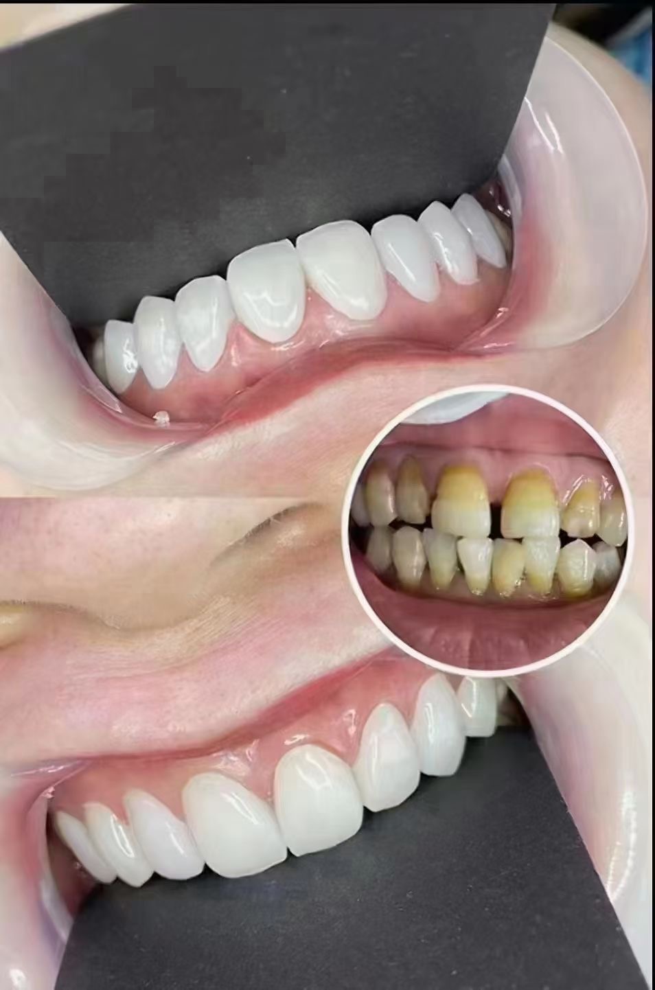 美牙后需要怎样的护理才能保持效果？